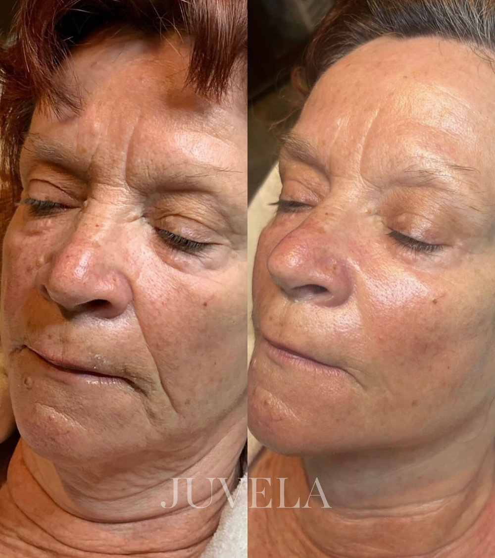 <p>They tried every expensive treatment  until this 5-minute ritual brought their glow back </p>