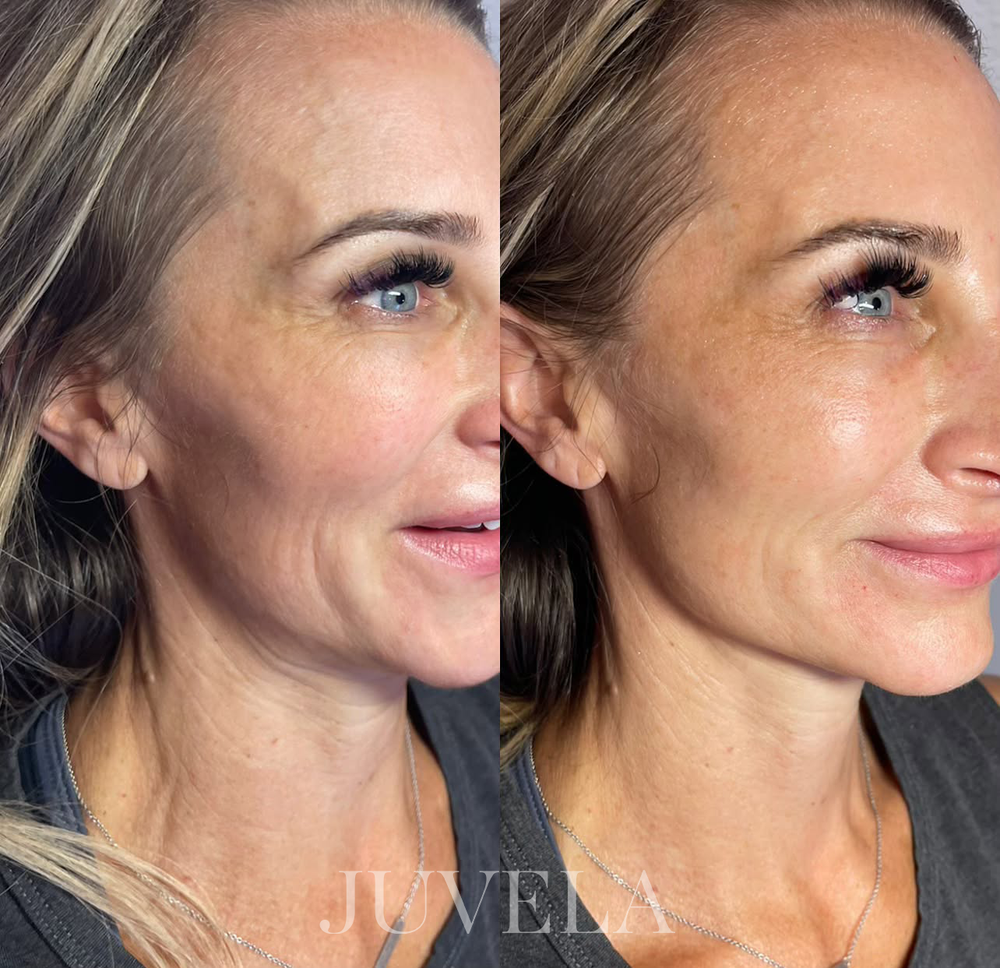 <p>They tried every expensive treatment  until this 5-minute ritual brought their glow back </p>