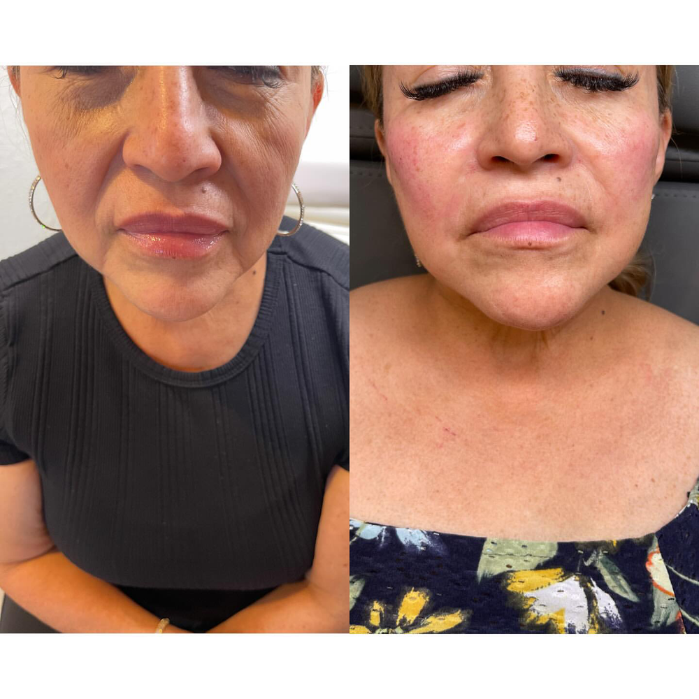 <p><strong>For every woman who’s tired of wasting money on routines that never delivered — this ritual was made to actually make a difference.</strong></p>
