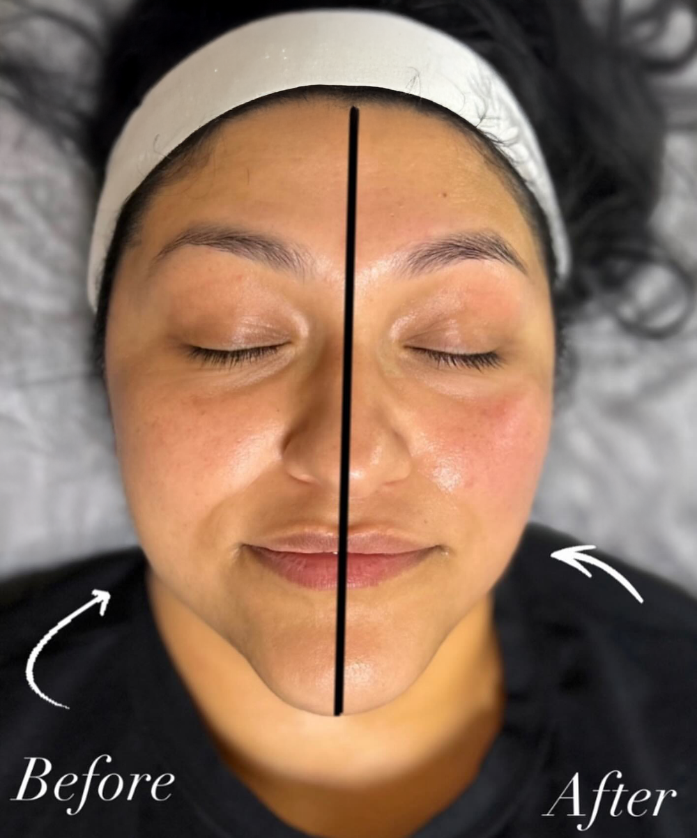 <p>They tried every expensive treatment  until this 5-minute ritual brought their glow back </p>