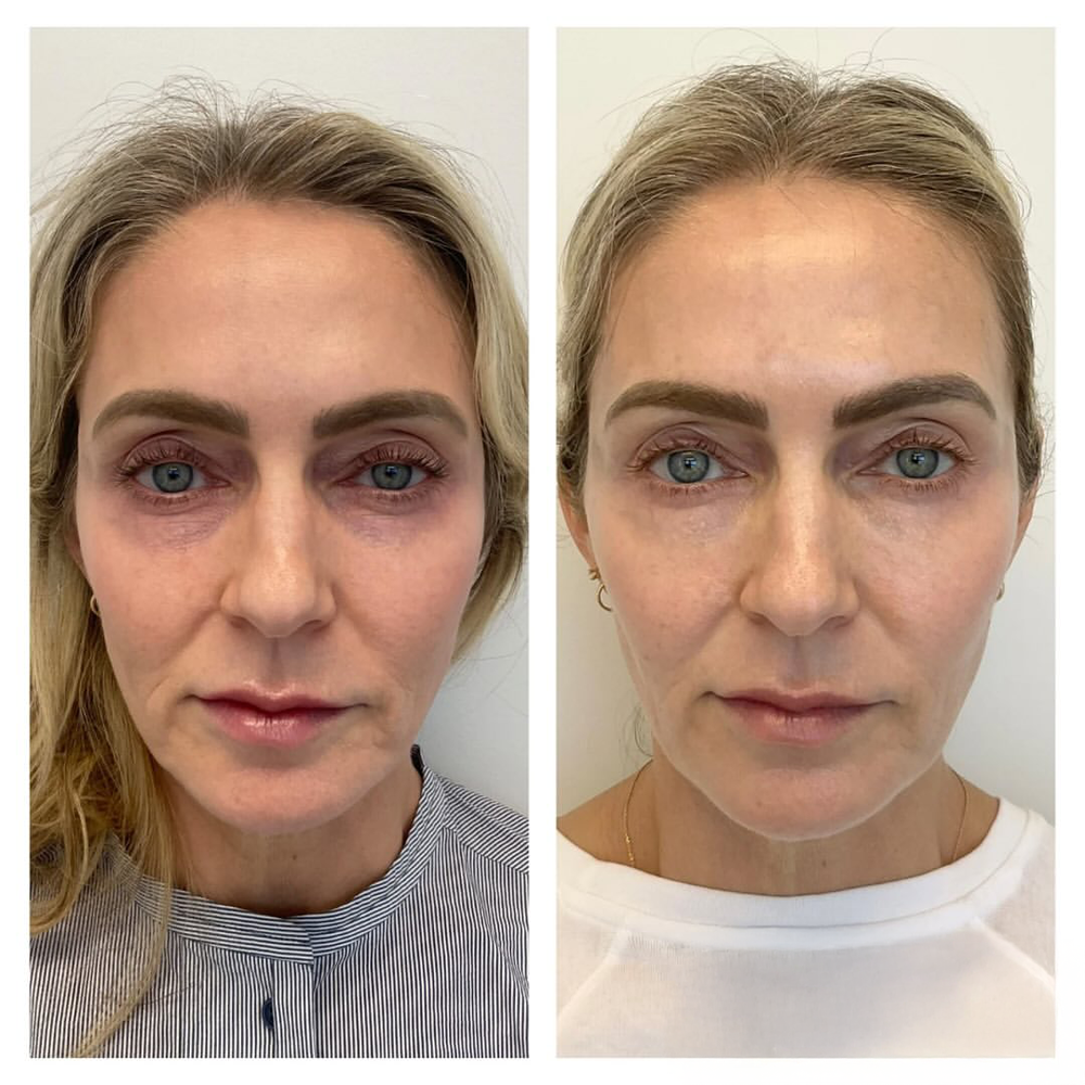<p><strong>For every woman who’s tired of wasting money on routines that never delivered — this ritual was made to actually make a difference.</strong></p>