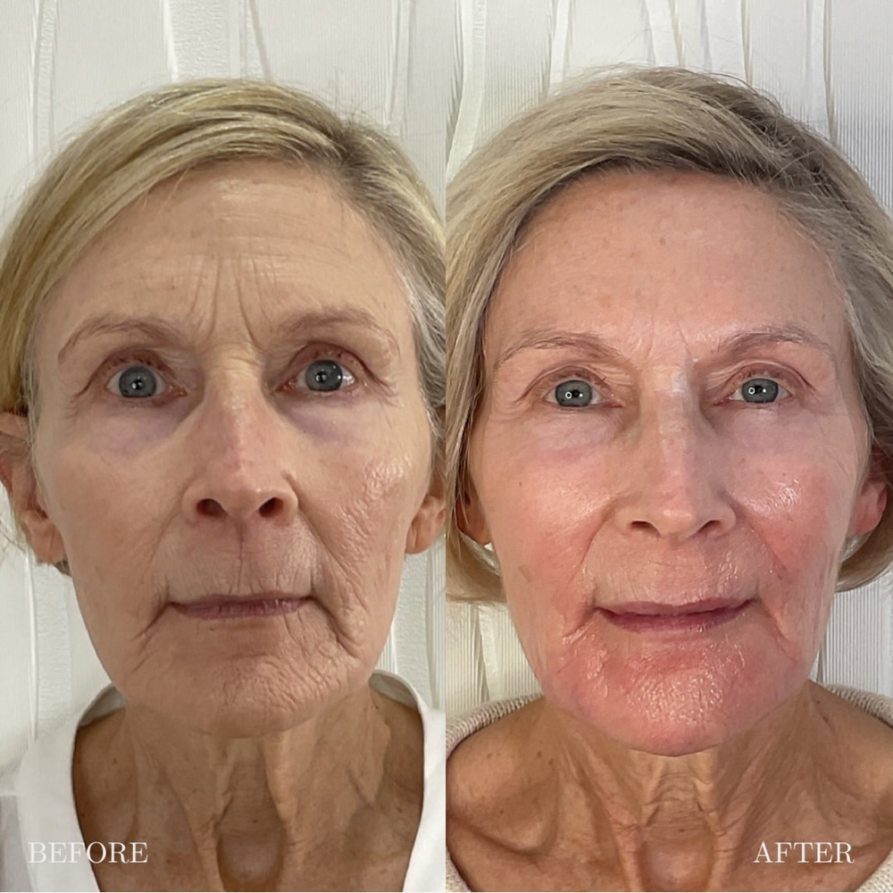 <p>They tried every expensive treatment  until this 5-minute ritual brought their glow back </p>