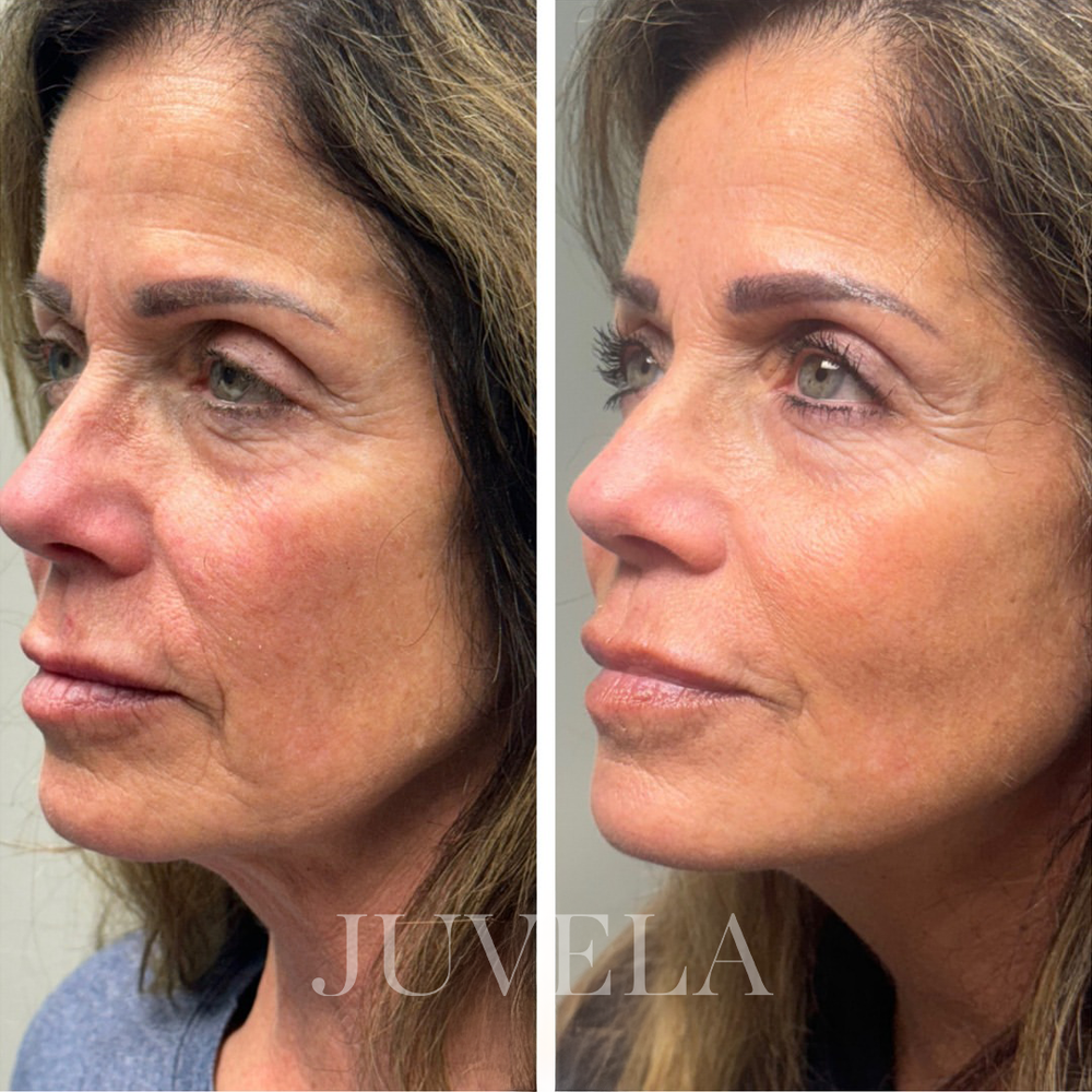 <p>Clinical-Level Skin Results, At Home</p>