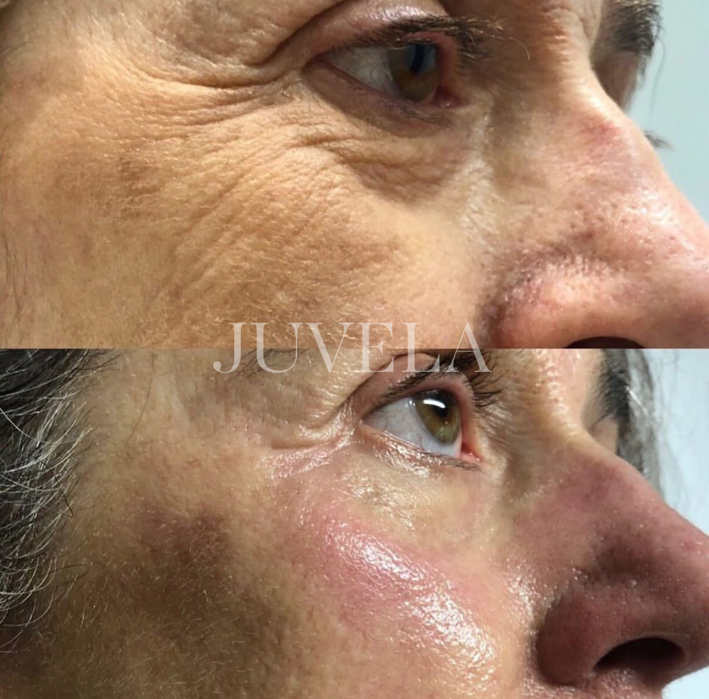 <p>They tried every expensive treatment  until this 5-minute ritual brought their glow back </p>